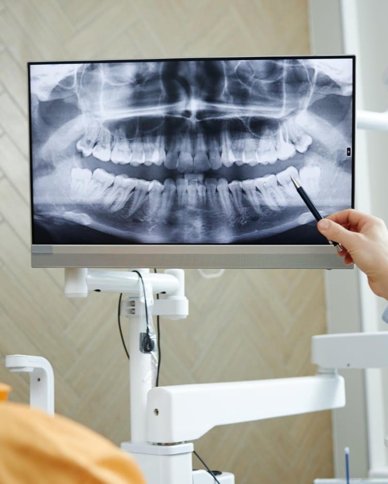 Dental X-Rays